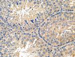 SFRP2 Antibody in Immunohistochemistry (Paraffin) (IHC (P))