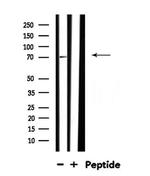 PLK3 Antibody in Western Blot (WB)