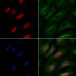 PPP2R5A Antibody in Immunocytochemistry (ICC/IF)