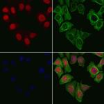 PPP2R5A Antibody in Immunocytochemistry (ICC/IF)