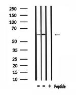 PPP2R5A Antibody in Western Blot (WB)