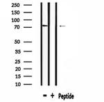 SLC6A8 Antibody in Western Blot (WB)