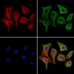 OATP2 Antibody in Immunocytochemistry (ICC/IF)