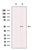 eIF2b gamma Antibody in Western Blot (WB)