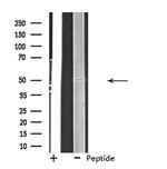 eIF2b gamma Antibody in Western Blot (WB)