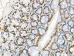 UBAP2L Antibody in Immunohistochemistry (Paraffin) (IHC (P))