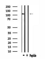 CACNA2D4 Antibody in Western Blot (WB)