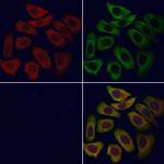 CaV3.2 Antibody in Immunocytochemistry (ICC/IF)