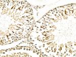 Osr2 Antibody in Immunohistochemistry (Paraffin) (IHC (P))