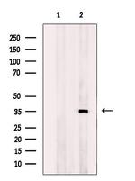 Osr2 Antibody in Western Blot (WB)