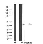 Osr2 Antibody in Western Blot (WB)