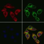 CYP11A1 Antibody in Immunocytochemistry (ICC/IF)