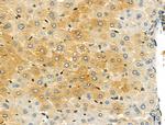 CYP11A1 Antibody in Immunohistochemistry (Paraffin) (IHC (P))