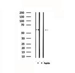 CYP11A1 Antibody in Western Blot (WB)