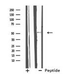 IL13RA2 Antibody in Western Blot (WB)