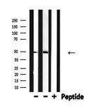 IL13RA2 Antibody in Western Blot (WB)