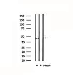 IL18BP Antibody in Western Blot (WB)