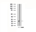 MYL3 Antibody in Western Blot (WB)