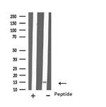 MYL6 Antibody in Western Blot (WB)