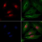 CHFR Antibody in Immunocytochemistry (ICC/IF)