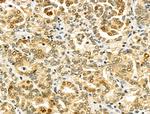 CHFR Antibody in Immunohistochemistry (Paraffin) (IHC (P))