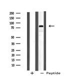 CHFR Antibody in Western Blot (WB)