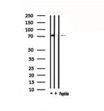 CHFR Antibody in Western Blot (WB)