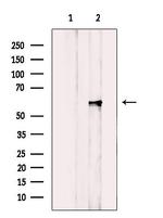 CYP2A6 Antibody in Western Blot (WB)