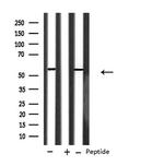 CYP2A6 Antibody in Western Blot (WB)