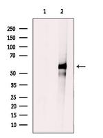 CYP2A7 Antibody in Western Blot (WB)