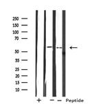 CYP2A7 Antibody in Western Blot (WB)