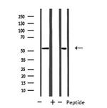 CYP39A1 Antibody in Western Blot (WB)