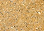 LRP8 Antibody in Immunohistochemistry (Paraffin) (IHC (P))