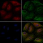 CD205 Antibody in Immunocytochemistry (ICC/IF)