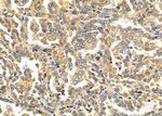 CD205 Antibody in Immunohistochemistry (Paraffin) (IHC (P))