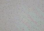 LIM1 Antibody in Immunohistochemistry (Paraffin) (IHC (P))