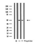 LIM1 Antibody in Western Blot (WB)