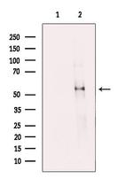 FIBB Antibody in Western Blot (WB)