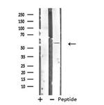 FIBB Antibody in Western Blot (WB)