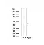 TPRA1 Antibody in Western Blot (WB)