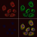 GPR133 Antibody in Immunocytochemistry (ICC/IF)