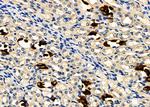 GPR133 Antibody in Immunohistochemistry (Paraffin) (IHC (P))