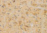 NPY1R Antibody in Immunohistochemistry (Paraffin) (IHC (P))