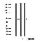 AVPR1B Antibody in Western Blot (WB)