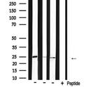 BAK Antibody in Western Blot (WB)