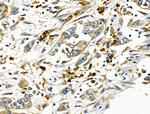 MTAP Antibody in Immunohistochemistry (Paraffin) (IHC (P))