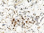 MTAP Antibody in Immunohistochemistry (Paraffin) (IHC (P))