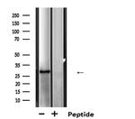 MTAP Antibody in Western Blot (WB)