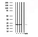 Rho Pan Antibody in Western Blot (WB)