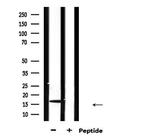 RNase12 Antibody in Western Blot (WB)